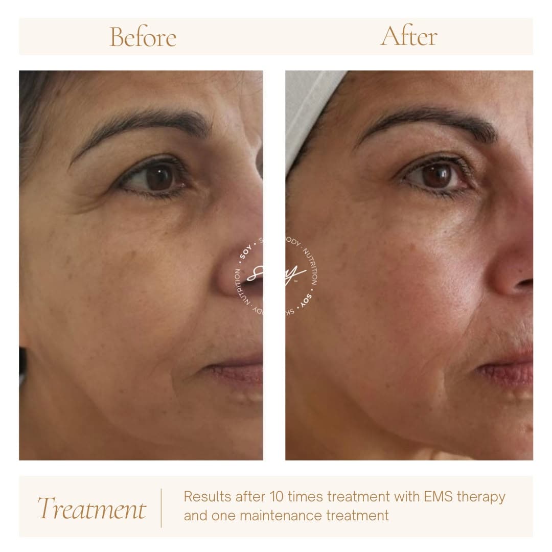 Before & after 1