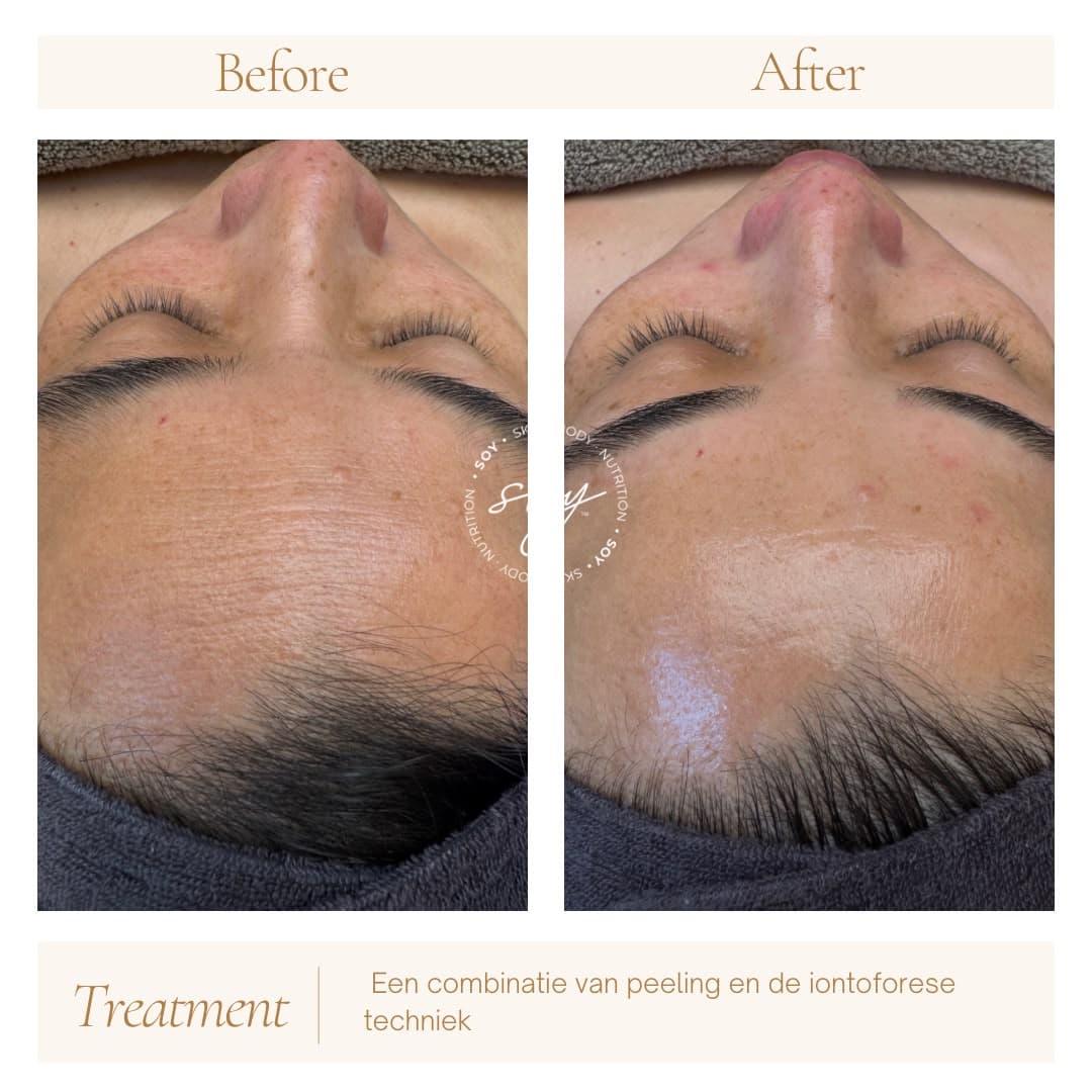 Before & after 2