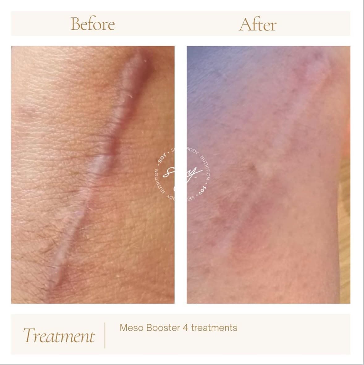 Before & after 4