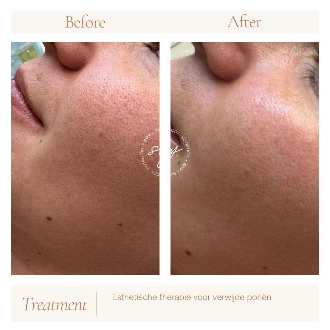 Before & after 5