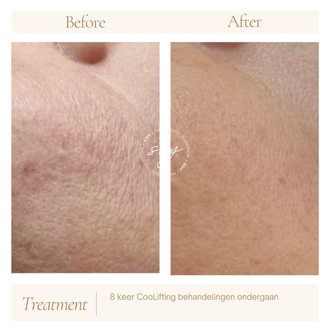 Before & after 6