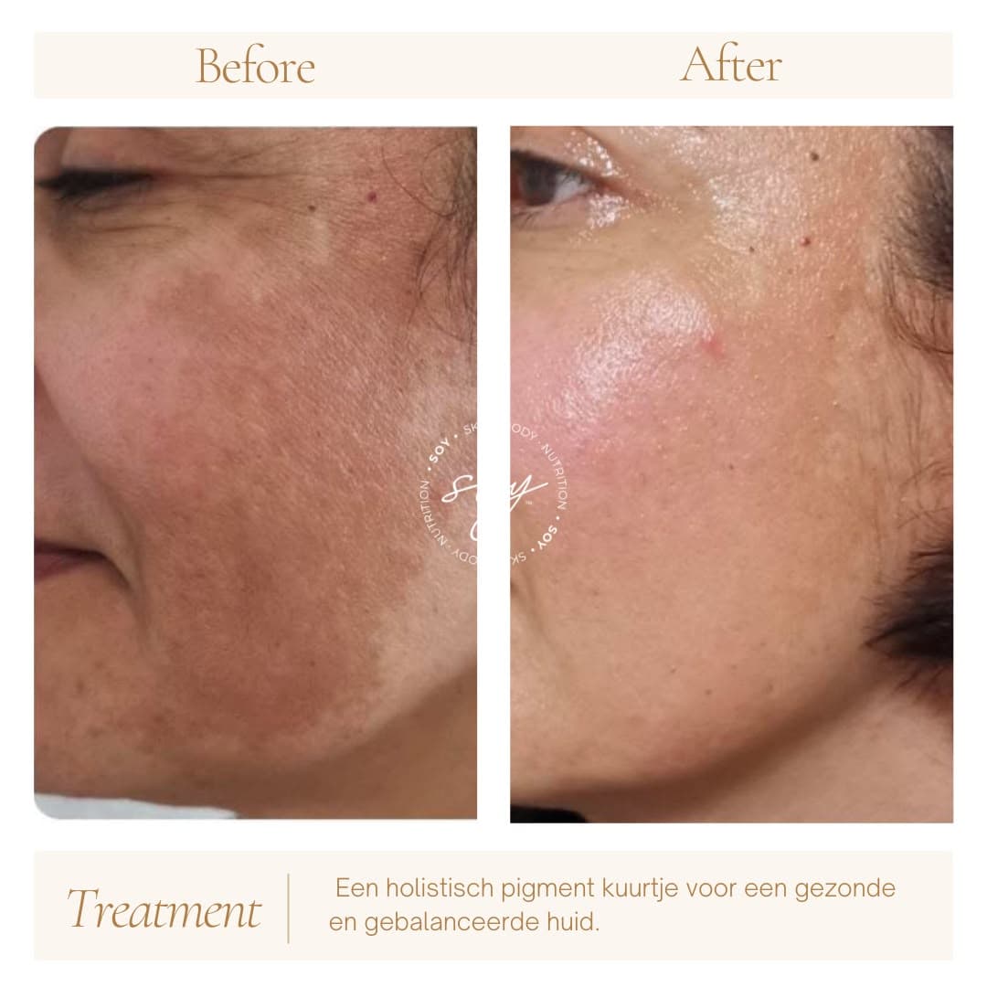 Before & after 8
