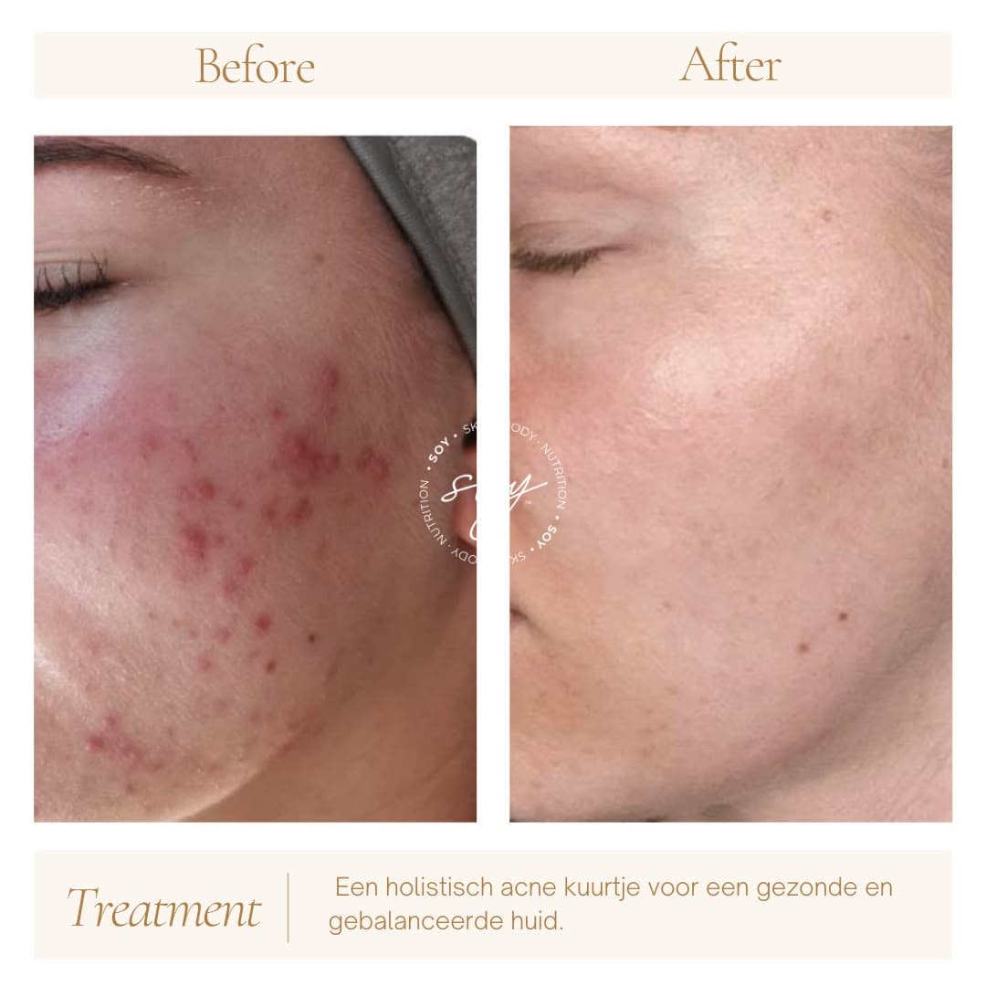 Before & after 9